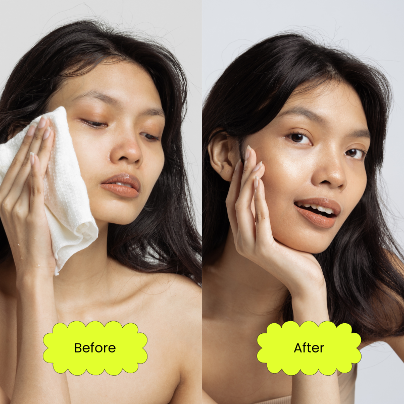 Fibora Vitamin C Face Serum – Brighten, Firm & Even Skin Tone – For All Skin Types (30ml)